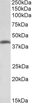 IHC-plus™ THNSL2 Antibody (aa192-204)