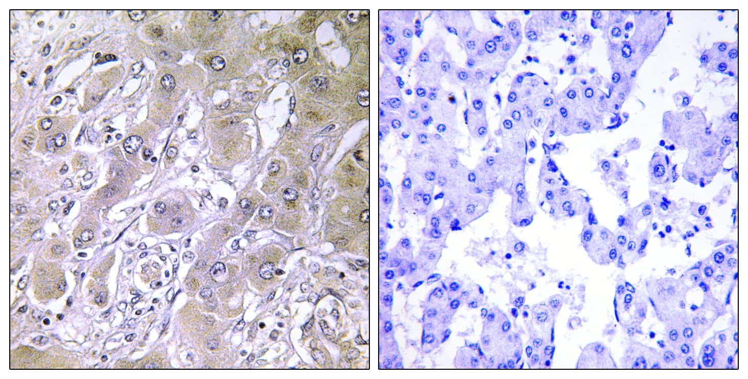 ACOT12 Antibody (aa281-330)