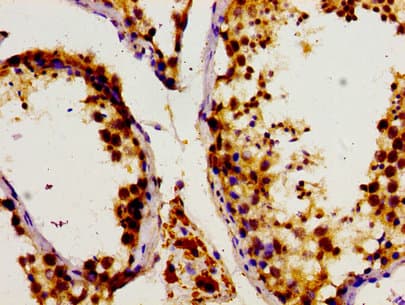 DHPS Antibody