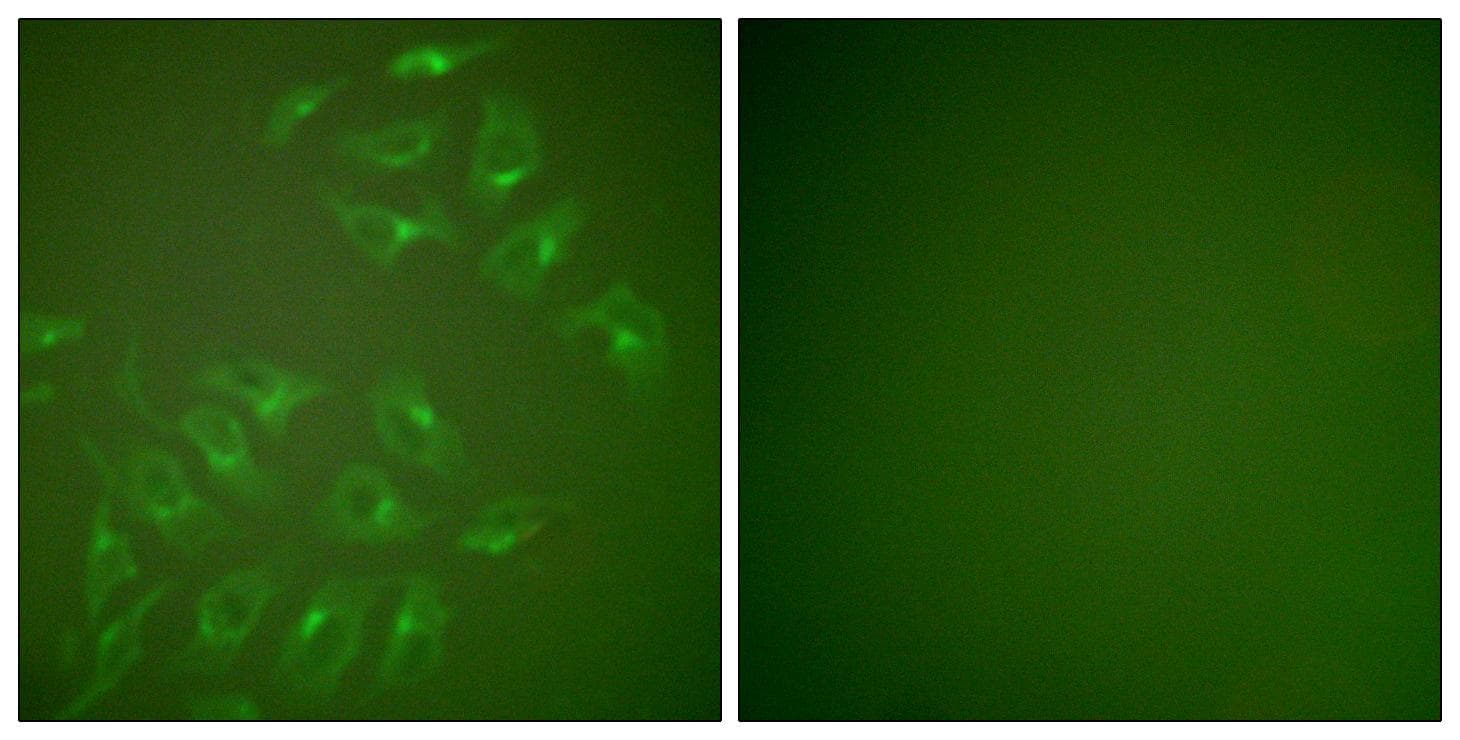 MMP13 Antibody