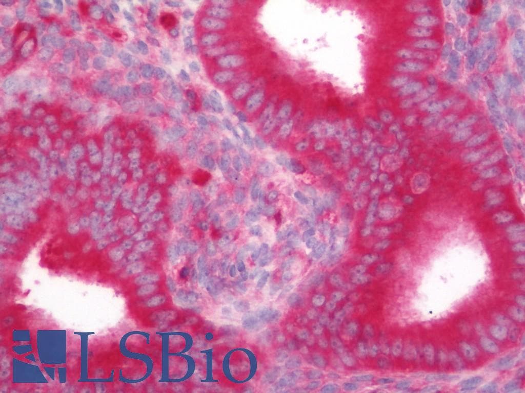 IHC-plus™ CDKN3 / KAP Antibody (clone 2E11)