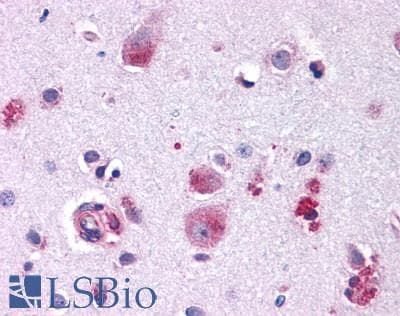 PathPlus™ FZD9 / Frizzled 9 Antibody (N-Terminus)