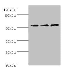 ACVR1C / ALK7 Antibody (aa22-113)