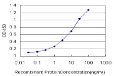 IHC-plus™ SAFB1 / SAFB Antibody (clone 5A11)