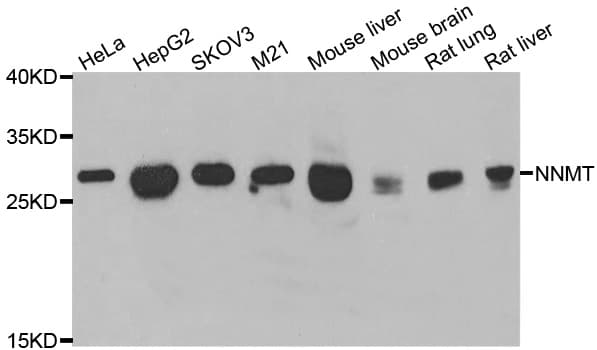 Polyclonal Rabbit anti-Human NNMT Antibody (IHC, IF, WB)