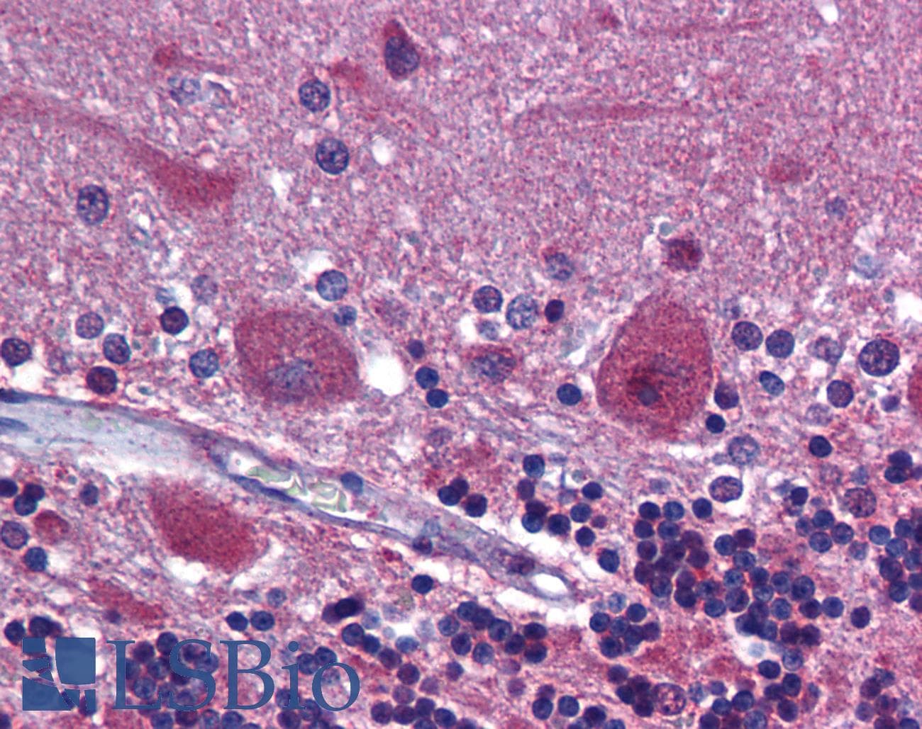 PathPlus™ PDGFRA / PDGFR Alpha Antibody (aa1000-C-term)