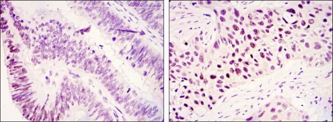 KDM3A / JMJD1A Antibody (clone 1E+12)