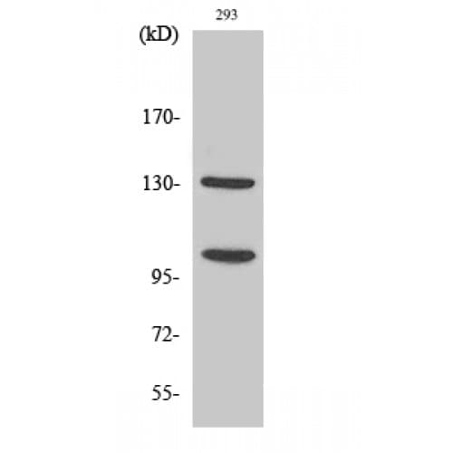 NOTCH2 Antibody (1660-1740 aa, Internal)