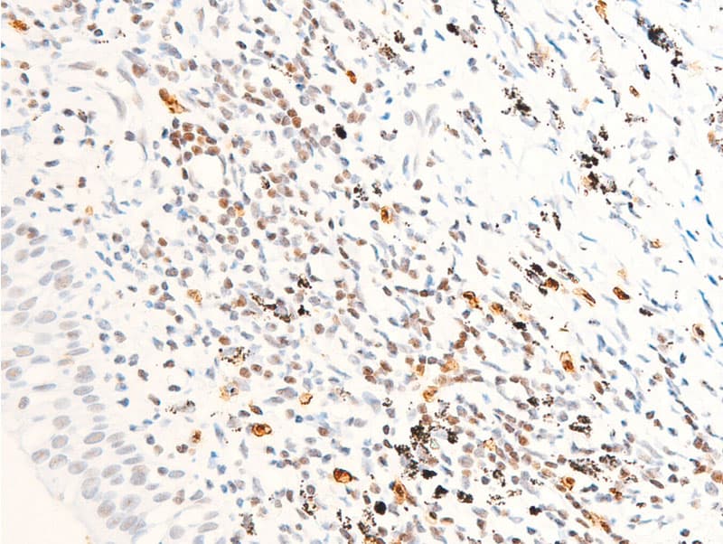 Polyclonal Rabbit anti-Human ERBB2 / HER2 Antibody (phospho-Tyr1112, IHC, IF, WB)