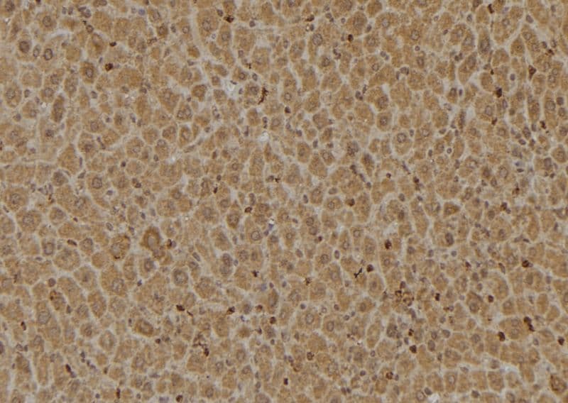 HGH1 / FAM203A Antibody