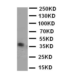 KLK5 / Kallikrein 5 Antibody (aa278-293)