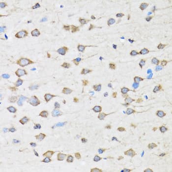 Polyclonal Rabbit anti-Human COPB2 / Beta-COP Antibody (IHC, IF, WB)