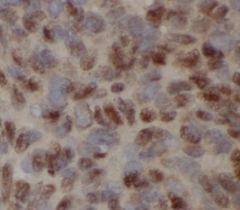 SQSTM1 Antibody