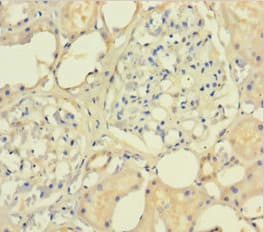 SMARCB1 / INI1 Antibody (aa2-376)
