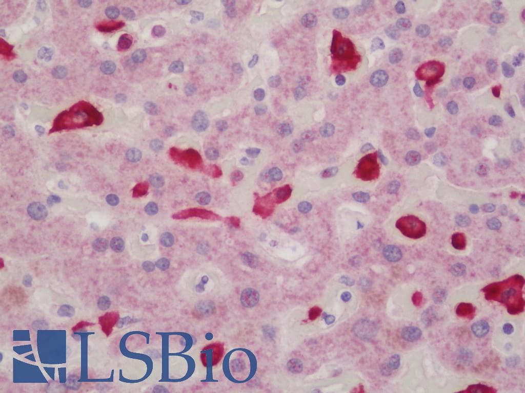 PathPlus™ Polyclonal Rabbit anti-Human AIF1 / IBA1 Antibody (IHC, WB)