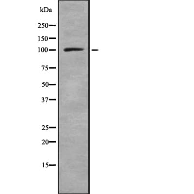 ARTS1 / ERAP1 Antibody