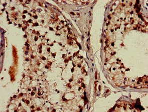DDX4 / VASA Antibody