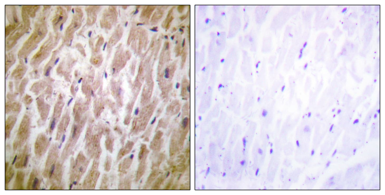 Polyclonal Rabbit anti-Human MAPKAPK2 / MAPKAP Kinase 2 Antibody (aa188-237, IHC, WB)