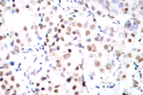 CREB1 / CREB Antibody (Ile127)