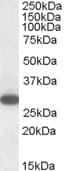 IHC-plus™ Polyclonal Goat anti-Human RGS18 Antibody (aa221-235, IHC, WB)