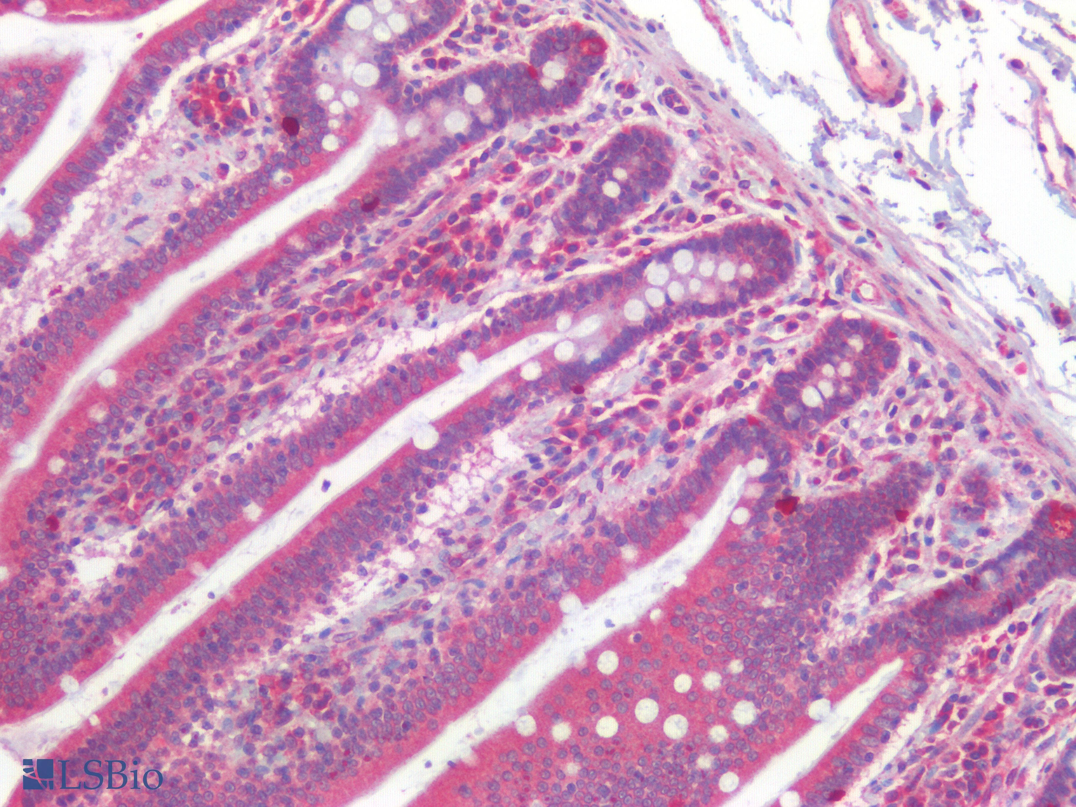 PathPlus™ Polyclonal Rabbit anti-Human CANX / Calnexin Antibody (IHC)