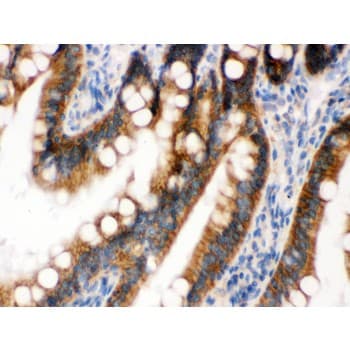 Polyclonal Rabbit anti-Human RENT1 / UPF1 Antibody (aa578-614, IHC, WB)