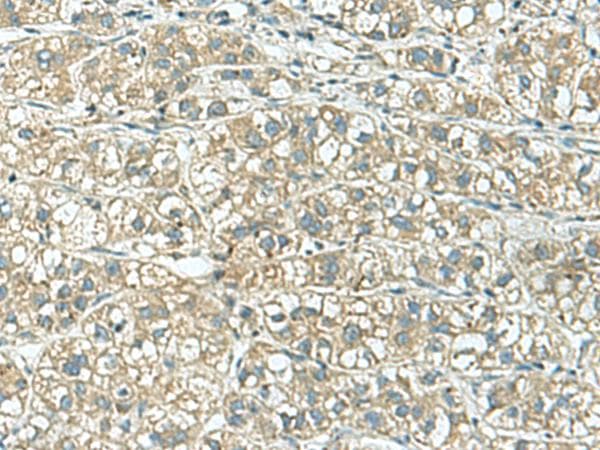 KCNJ2 / Kir2.1 Antibody