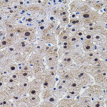 DAP-5 / EIF4G2 Antibody
