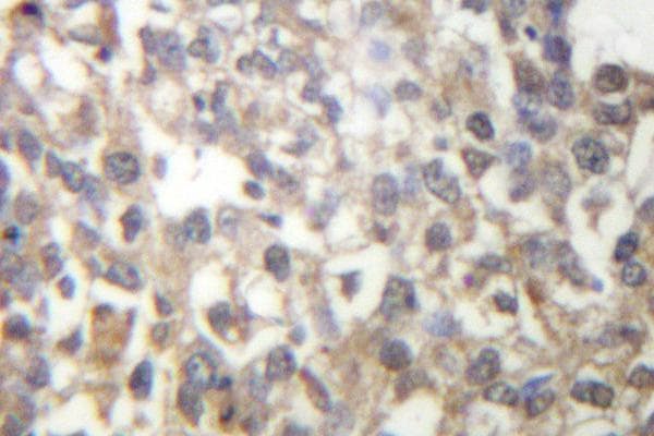 TUBG1 / Tubulin Gamma 1 Antibody (Phe414)