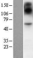 SIM2 Protein (Over-Expression Lysate Myc-DDK (Flag))