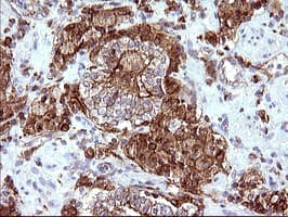 SCAMP2 Antibody (clone OTI3C2)