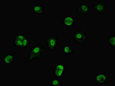 Polyclonal Rabbit anti-Human TRIM33 / TIF1-Gamma Antibody