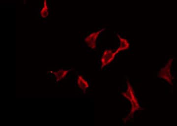 PLA2G6 / IPLA2 Antibody