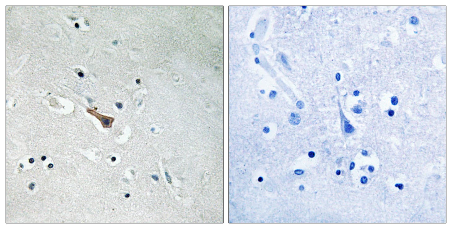 APLP2 Antibody (phospho-Tyr755)