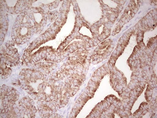 ABCB1 / MDR1 / P Glycoprotein Antibody (aa995-1280, clone OTI1A7)
