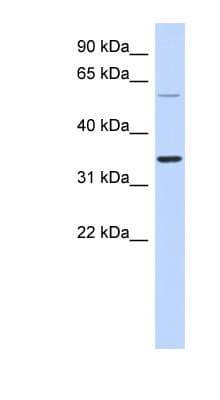 ASPRV1 / SASPase Antibody (aa143-192)