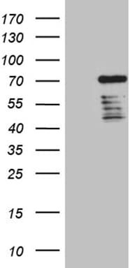 DCP1B Antibody (aa167-473, clone OTI1G8)