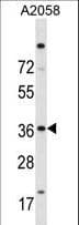 Polyclonal Rabbit anti-Human ISL2 / Islet 2 Antibody (aa1-30, IF, WB)