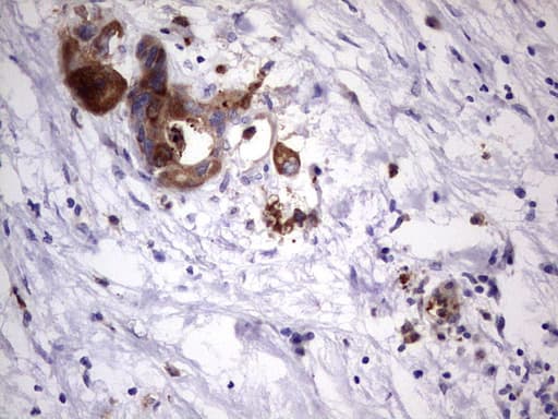 LAMB3 / Laminin Beta 3 Antibody (aa424-773, clone OTI3A2)