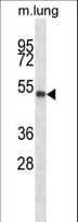 PBX2 Antibody (aa181-210)