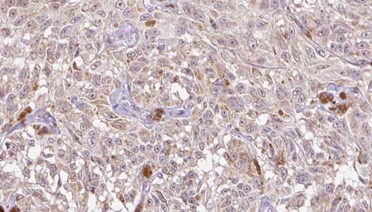 IL8 / Interleukin 8 Antibody