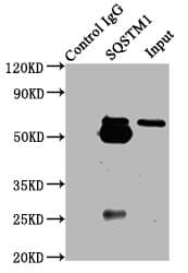 Polyclonal Rabbit anti-Human SQSTM1 Antibody (IHC, IF)