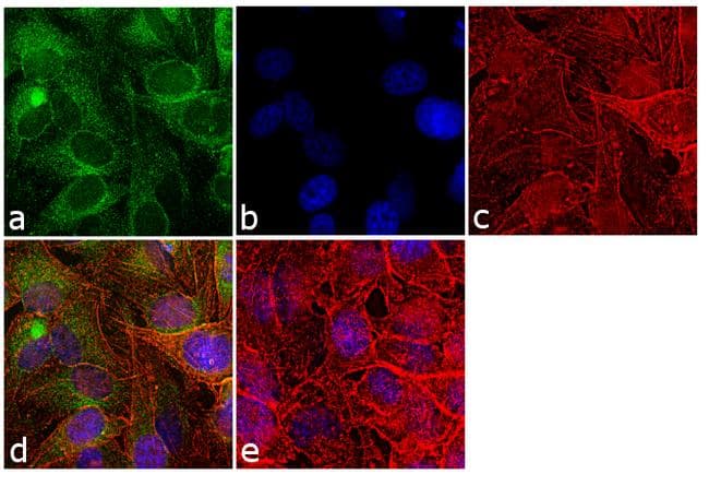 PPIB / Cyclophilin B Antibody
