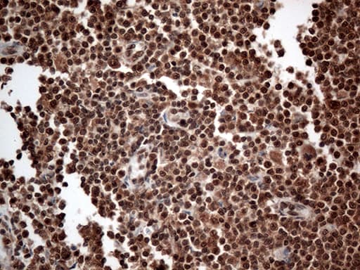 CDK15 / ALS2CR7 Antibody (aa293-378, clone OTI1E1)