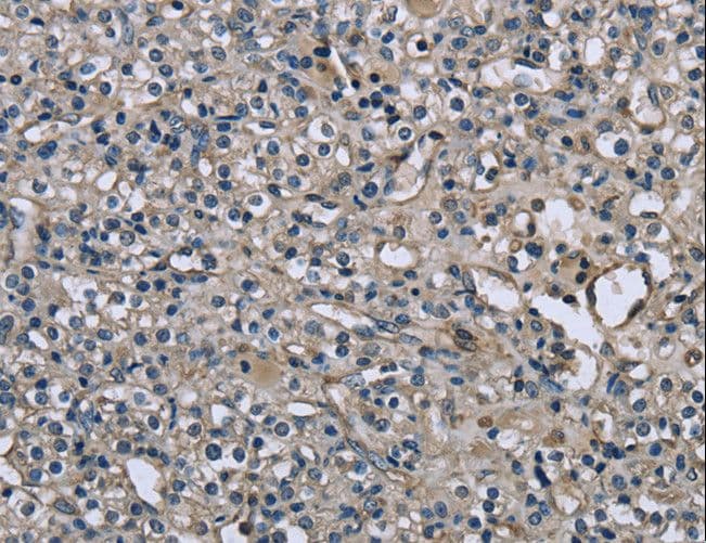 Polyclonal Rabbit anti-Human MRLC2 / MYL12B Antibody (IHC, WB)
