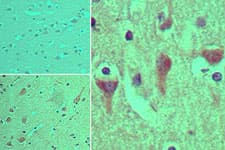 Polyclonal Rabbit anti-Human ASAP3 Antibody (aa693-710, IHC)