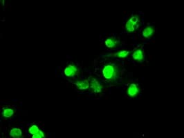 SATB1 Antibody (clone OTI6C6, Carrier-free)