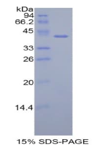 Human HIST1H2AH Protein (Recombinant His-GST)