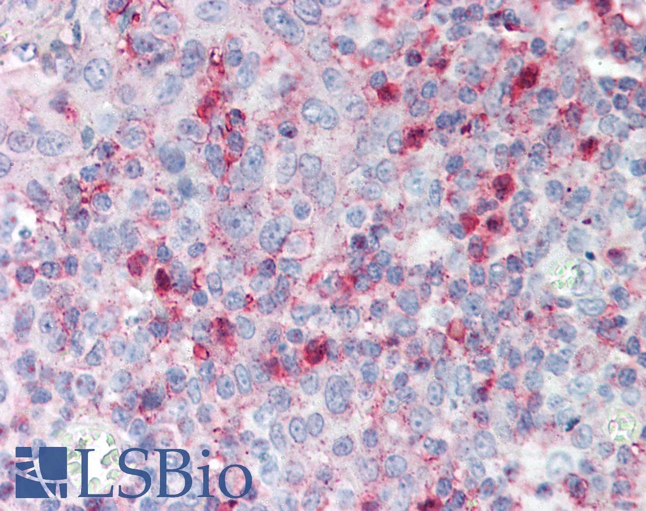 IHC-plus™ SPON2 / MINDIN Antibody (aa301-315)
