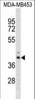 Polyclonal Rabbit anti-Human TRMU Antibody (aa128-154, WB)